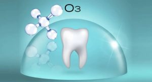کاربرد اوزون تراپی در دندان پزشکی